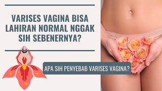 APAKAH VARISES VAGINA BERBAHAYA? BISA LAHIRAN NORMAL KAH?