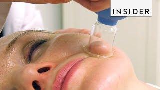 Face Cupping Gives Instant Facelift