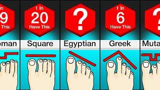 Comparison Different Types Of Feet