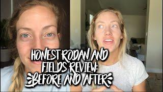 My Honest Rodan and Fields Skincare Review