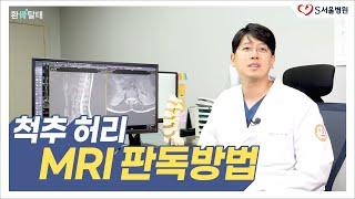 허리 디스크수술 해야하나?  MRI 판독 방법 알려드림