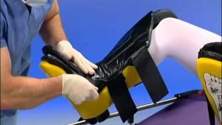 Allen Medical  Allen Stirrups  Instructional Video