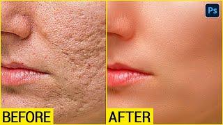 Face ko Smooth kaise kare  High - End Skin Retouching Photoshop Tutorial in Hindi  SABKE SAB