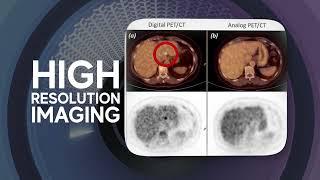 Digital PET CT Scan Segera Hadir di Mandaya Royal Hospital Puri  GE OMNI Legend