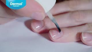FUNGISTOP 3-IN-1 NAIL TREATMENT - NZ