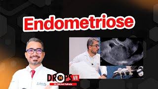 AULÃO SOBRE ENDOMETRIOSE - TUDO QUE VOCÊ PRECISA SABER I DR. MICHEL PALHETA I VOCÊ RADIOLOGISTA