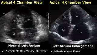 Echocardiography Normal Vs Abnormal Images  Heart Ultrasound  Cardiac ColorSpectral Doppler USG