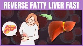 4 Types of Foods to Avoid to Reverse Fatty Liver Disease Fast NAFLD