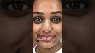 At home nose job??