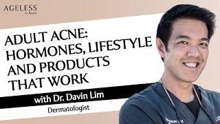 Adult Acne Hormones Lifestyle and Products that Work