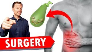 Gallbladder Surgery Removal WATCH THIS