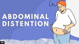 Abdominal Distention Everything You Need To Know