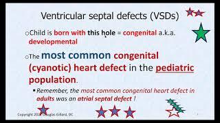 Ventricular Septal Defect Tetralogy of Fallot and Endocarditis A Live Lecture