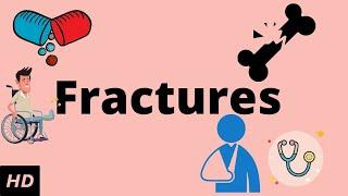 Fractures Causes Signs and Symptoms Diagnosis and Treatment.