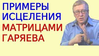 Примеры исцеления матрицами Гаряева. Редкое интервью академика фрагменты