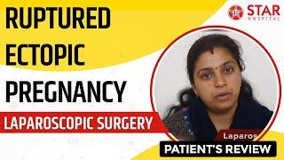 Ruptured Ectopic Pregnancy  Tubal Pregnancy Laparoscopic Surgery Key Hole Surgery Jalandhar Punjab