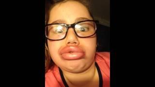 Kylie Jenner lip challenge fail