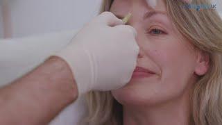 London BOTOX® Experts Explain Popular Injections Treatment for Wrinkles