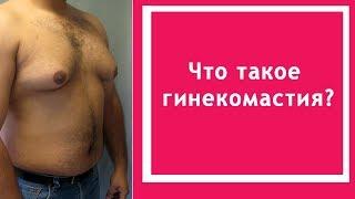 Что такое гинекомастия?