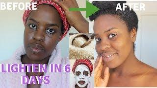 How I How i BRIGHTENED MY SKIN IN 6 DAYS REALISTIC and Natural way to reduce hyperpigmentation