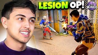 Why LESION Is The BEST OPERATOR... Rainbow Six Siege