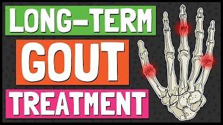 How to Prevent and Treat Gout