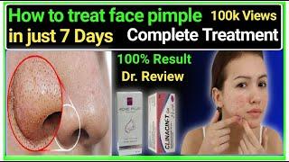 How to treat on face pimple  active acne permanently treatment  Dr review about acne removal...
