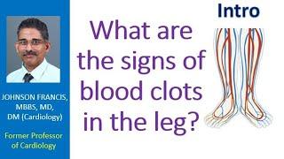 What are the signs of blood clots in the leg?