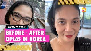 Potret Dian Nitami Pulang dari Oplas di Korea Tampak Lebih Muda Sudah Terlihat Meski Masih Memar