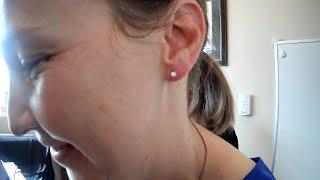 Medical Ear Piercing