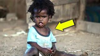 Man Adopts Abandoned Girl From Somalia. Just Look At Her Today