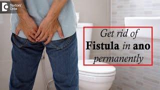 What is fistula in ano? Symptoms Diagnosis Risks Factors & Treatment options - Dr. Harish N S