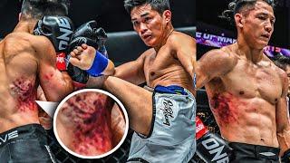 How Did Akimoto Survive Petchtanong’s Body Shots?  Fight Highlights