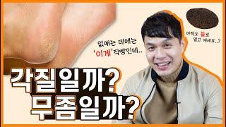 발뒤꿈치 갈라짐을 어떻게 해결할 수 있을까? I 원인 해결법 오해와 진실 Q&A I ‘이것’만 있으면 발이 맨들맨들해집니다