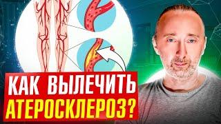 АТЕРОСКЛЕРОЗ О ЧЁМ ВРАЧИ НЕ ГОВОРЯТ БОЛЬНЫМ?