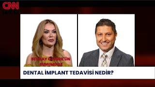 CNNTÜRK HER ŞEYDEN ÖNCE   DENTAL İMPLANT