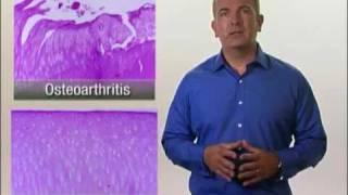 Arthritis in Dogs - Osteoarthritis