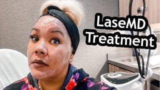 LaseMD Before And After  LaseMD Treatment  Laser Treatment Before And After  It Didnt Even Hurt