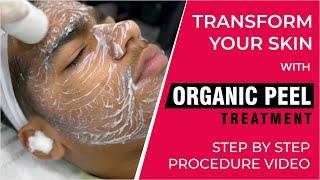 Transform Your Skin with Organic Peel Treatment  Step by Step Procedure Video  Sakhiya Skin Clinic