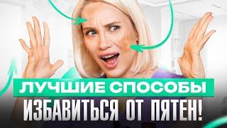 Как избавиться от пигментных пятен — 6 лучших способов