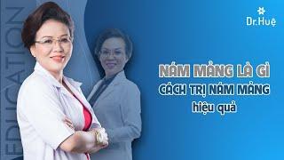 Nám mảng là gì? Cách điều trị nám mảng hiệu quả - Hotline BS. Huệ 0989.103.202