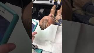 Head Getting Stitches in funny places - Diving Head Injury - MRDC RIPFEST