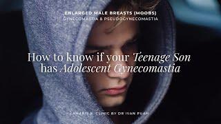 How to know if your teenage son has adolescent gynecomastia