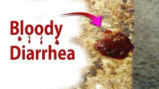 Bloody Diarrhea Coccidiosis