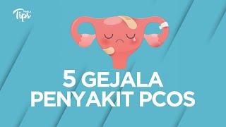 5 Gejala Penyakit PCOS yang Bikin Perempuan Susah Hamil