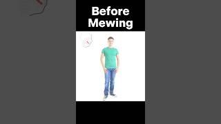 Mewing Transformation