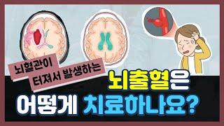 뇌출혈 치료ㅣ출혈성 뇌졸중뇌출혈 바로알기 EP.5