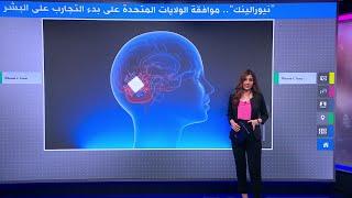 نيورالينك.. تقنية تستخدم شريحة المخ تدخل مرحلة التجارب على البشر