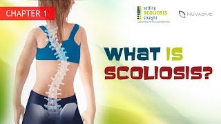 Ch.1 - What is Scoliosis?