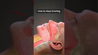 How to stop Snoring? ↪ 3D Medical Animation #Shorts #StopSnoring #Sleep #Snoring